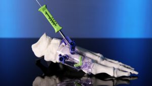 A medical device kit for correcting bunions shown in a complete kit.