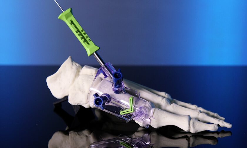 A medical device kit for correcting bunions shown in a complete kit.